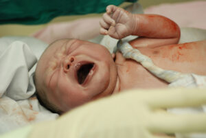 New born infant from cesarean section in operating theater.