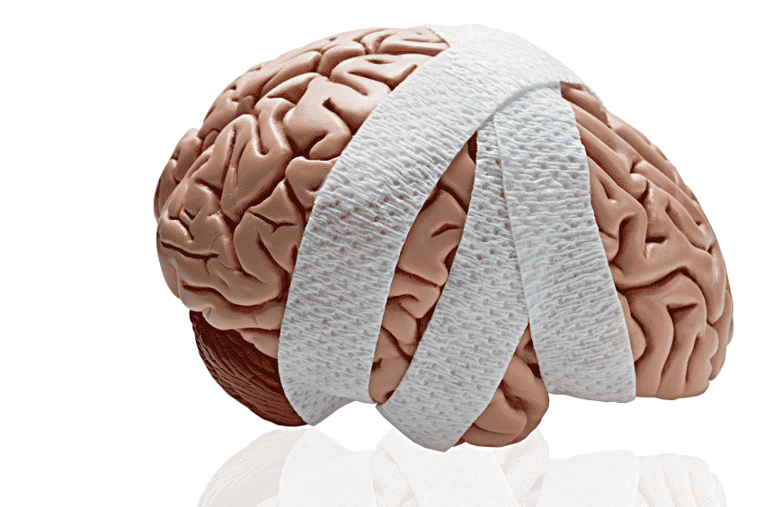 Brain Injury Representation