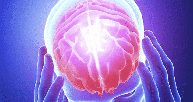 Headaches and Head Pain