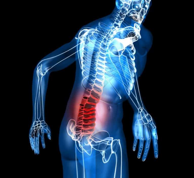 shooting-pain-in-lower-back-spine-causes-symptoms-and-treatment