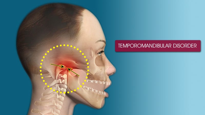 TMJ diagram