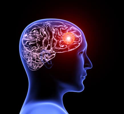 How Your Nervous System Benefits from Chiropractic Treatments